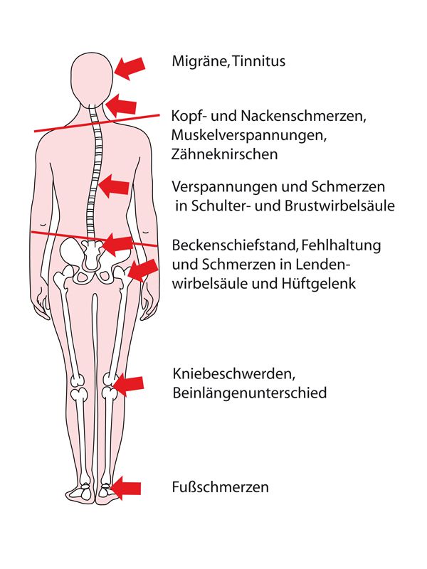 Wenn der Rücken auf dem Gebiet kaum niedriger als Schulterblätter weh tut